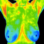 breast-Thermography