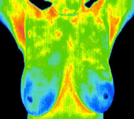 breast-Thermography